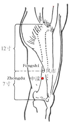 Zhongduxue
