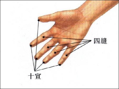 四缝