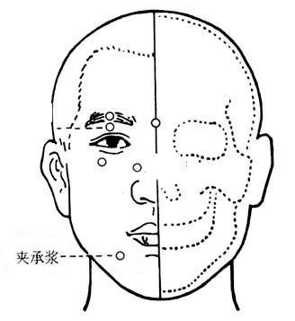 夹承浆