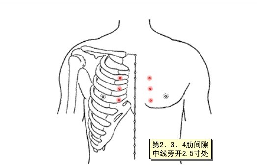 小儿龟胸穴