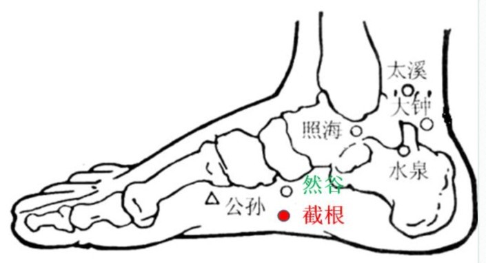 截根