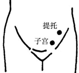 提托 