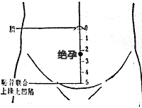 断户 