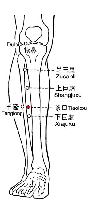 Tiaokou