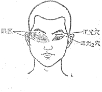 正光