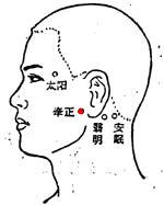 牵正