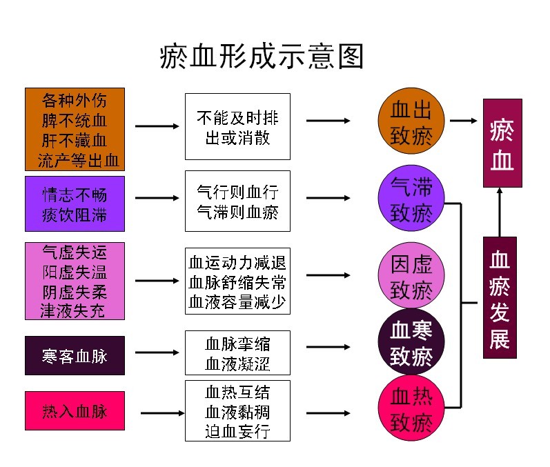 瘀血形成示意图