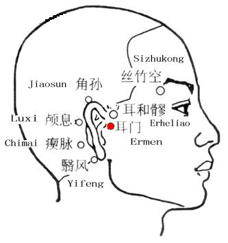 Ermen