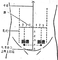 肠遗 