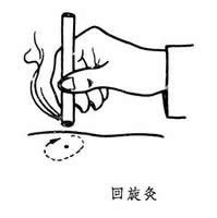 回旋灸