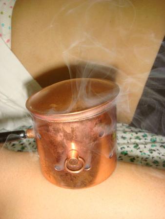 温灸器灸2