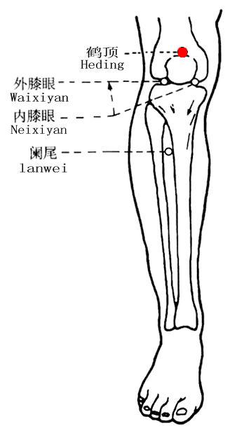 鹤顶